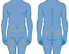 Locais para injeção incluem a barriga, frente das coxas, parte traseira da parte superior dos braços e a parte superior das nádegas.