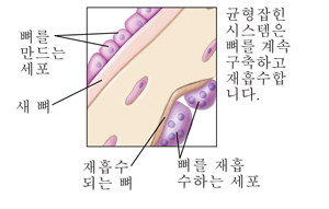 뼈를 재흡수하는 세포